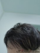 看着自己新添上去的头发，欣喜若狂