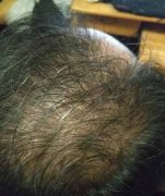 深深烙在心里的自卑感