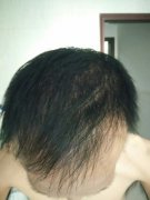 唯有叹气，这是永久的伤啊