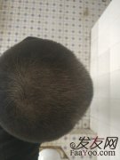 自从丢了头发，敏感性提高了不少