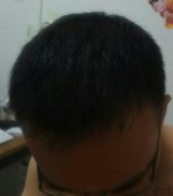 头发纤维粉帮助我走出自己的圈子