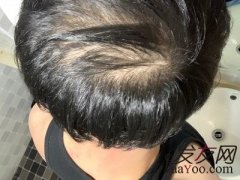 未曾在意的一个细节差点毁了我的生活