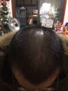 我的发缝随着苏玫氏头发纤维粉的到来也消失不见了