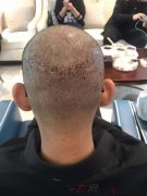 额角光光的这个大石头终于可以放下