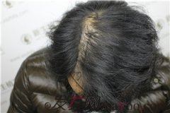 我选择头发纤维粉的眼光果然没错