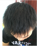 一直以来都被头发的问题深深困扰