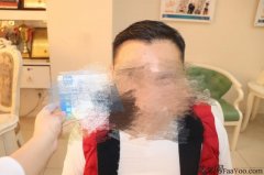 头发变多了心情也跟着变好了