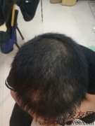 不断尝试，不断碰壁，最终走出困境