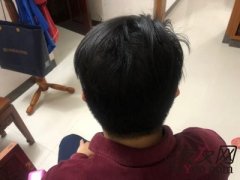 苏玫氏越用越好用，现在看中的是效果