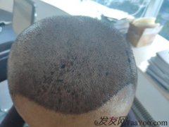 这个年纪却有了不该有的沧桑和失落