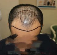 我现在期待的就是过年后的新面貌