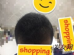 没想到脱发还能潜移默化的形象一个人的性格