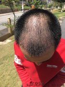  衷心感谢，让我找回那个昔日自信的自己