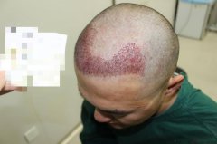 现在站在人前的我比以前更加自信了