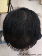 苏玫氏头发纤维粉，很庆幸遇到你