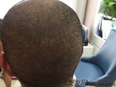 真后悔年轻时没日没夜的挥霍，头发也不见了