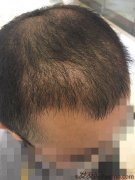 为了改变就必须接受现在的苦，风雨过后便是彩虹