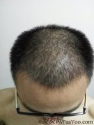 这半年来的小心翼翼换来今天的自己，还是值得的