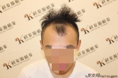 这是他们对于手术的一种责任感