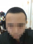 看着自己头上又种满了头发，心中充满了期待
