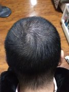   生长期的头发长得特别好，我自己都不敢相信了