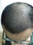 突然接到他们的回访电话让我特别意外