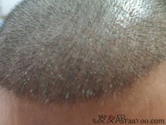 大功告成的时候，终于可以重见光明了