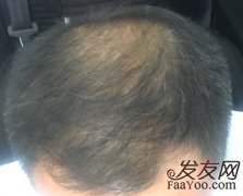 头发多了好心情也就多了