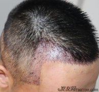 终于可以随随便便的留发型了，一想到这就开心