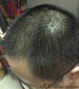 从今往后，再也不用害怕低头了