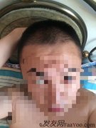 不知道一年以后会不会有效果，只有静静等待