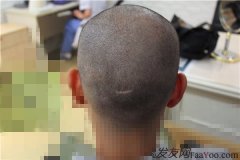  这些年心里一直有个伤口，不能愈合