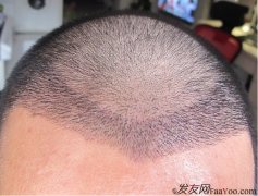  因为医生说的三个字让我心情低落了好一阵
