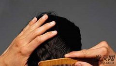  脱发比较常见的几种的治疗方法