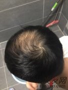 用完苏玫氏头发纤维粉之后年轻自信也跟着回来了