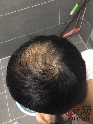 苏玫氏头发纤维粉