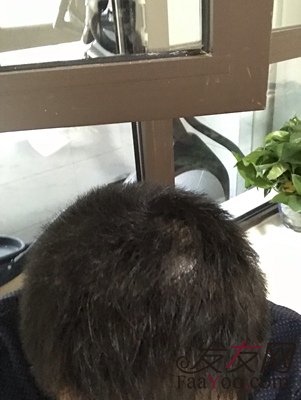 苏玫氏头发纤维粉