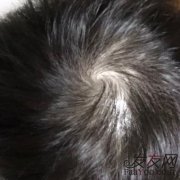  不得不说苏玫氏头发纤维粉效果太出乎意料了