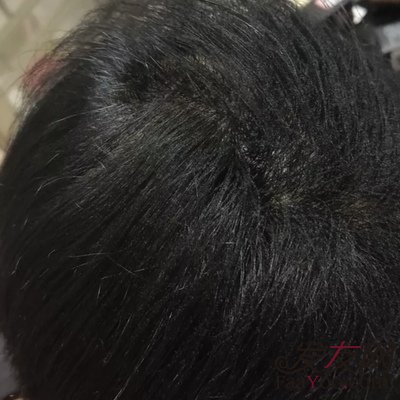 苏玫氏头发纤维粉