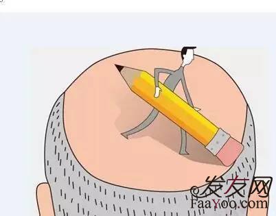 去长沙科发源植发好不好呢?