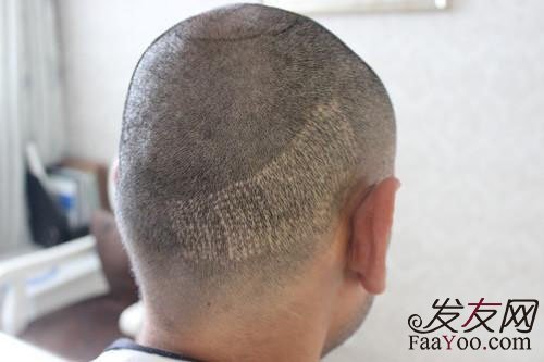 去长沙科发源植发好不好呢?