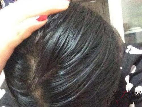 头发出油过多有什么危害呢？