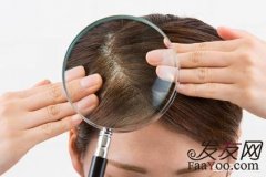 预防脱发吃哪些维生素比较好？