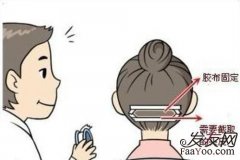 女性植发手术的时间要多久呢？