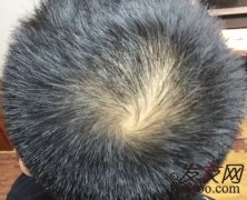 没想到自己会用苏玫氏头发纤维粉