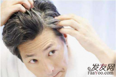 前额没有头发可以选择植发吗？