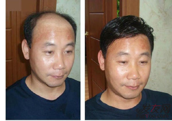 补发的效果好不好?