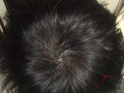 苏玫氏头发纤维粉