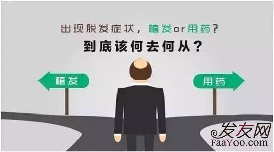 脂溢性脱发人群做植发能行吗?