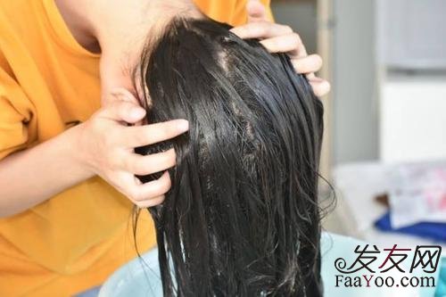 植发后几天能洗头?